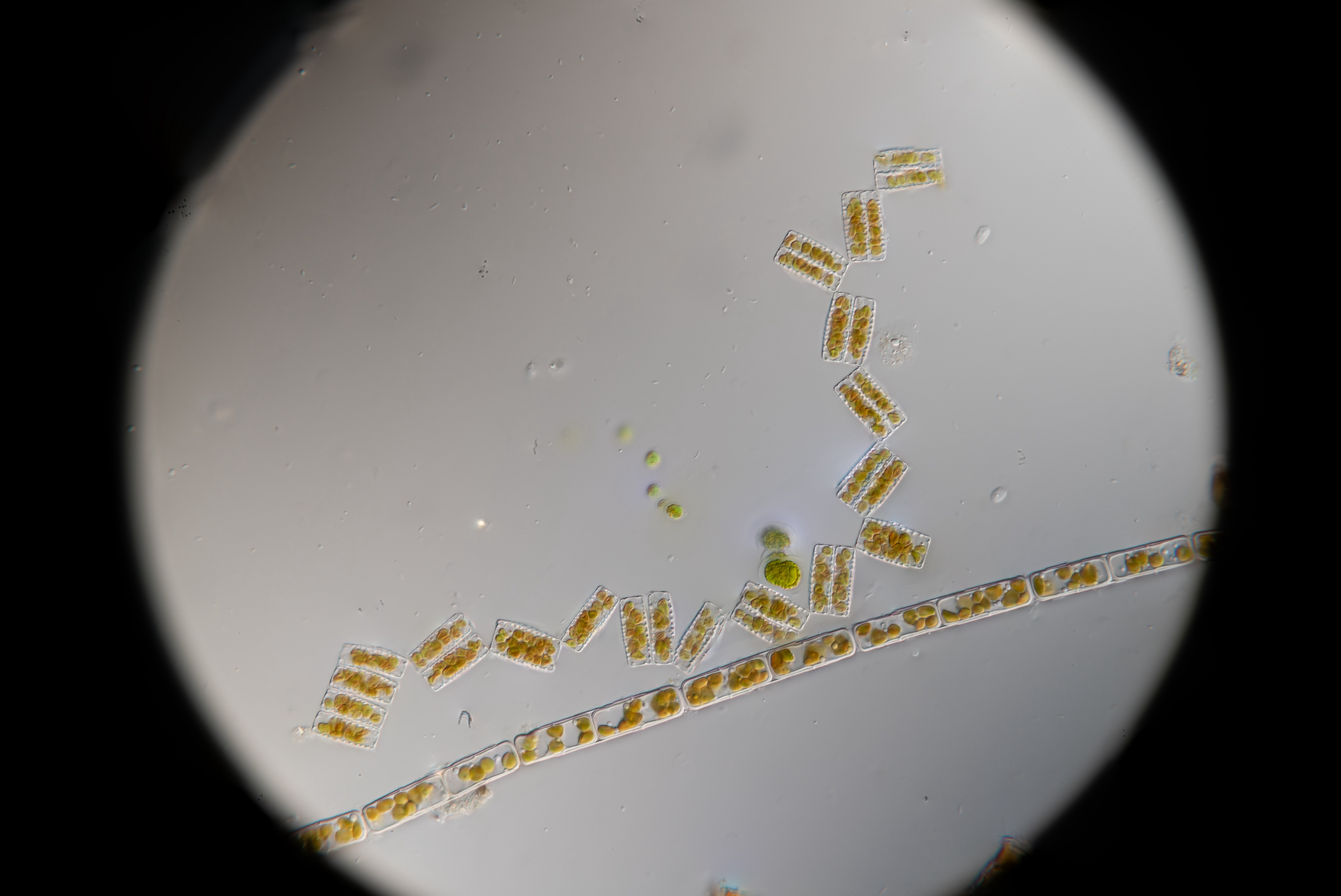 Diatom 1